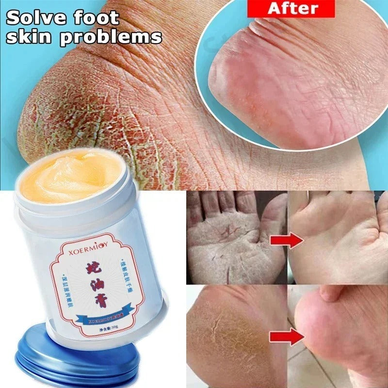 Day And Night Body Can Use Anti Freezing And Anti Cracking Hydrating Moisturizing Cream