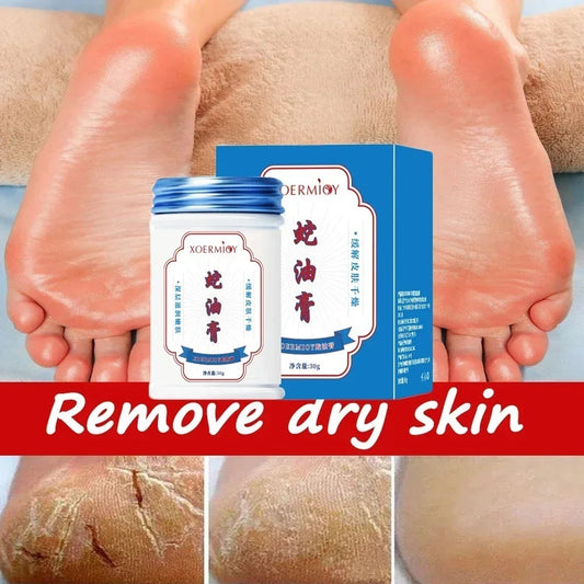 Day And Night Body Can Use Anti Freezing And Anti Cracking Hydrating Moisturizing Cream